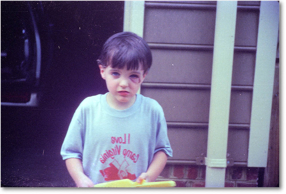 David_CampJayceeBlackEye_early1980s copy